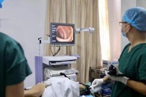 肠镜怎么做的过程视频,直观视频带你了解每一步